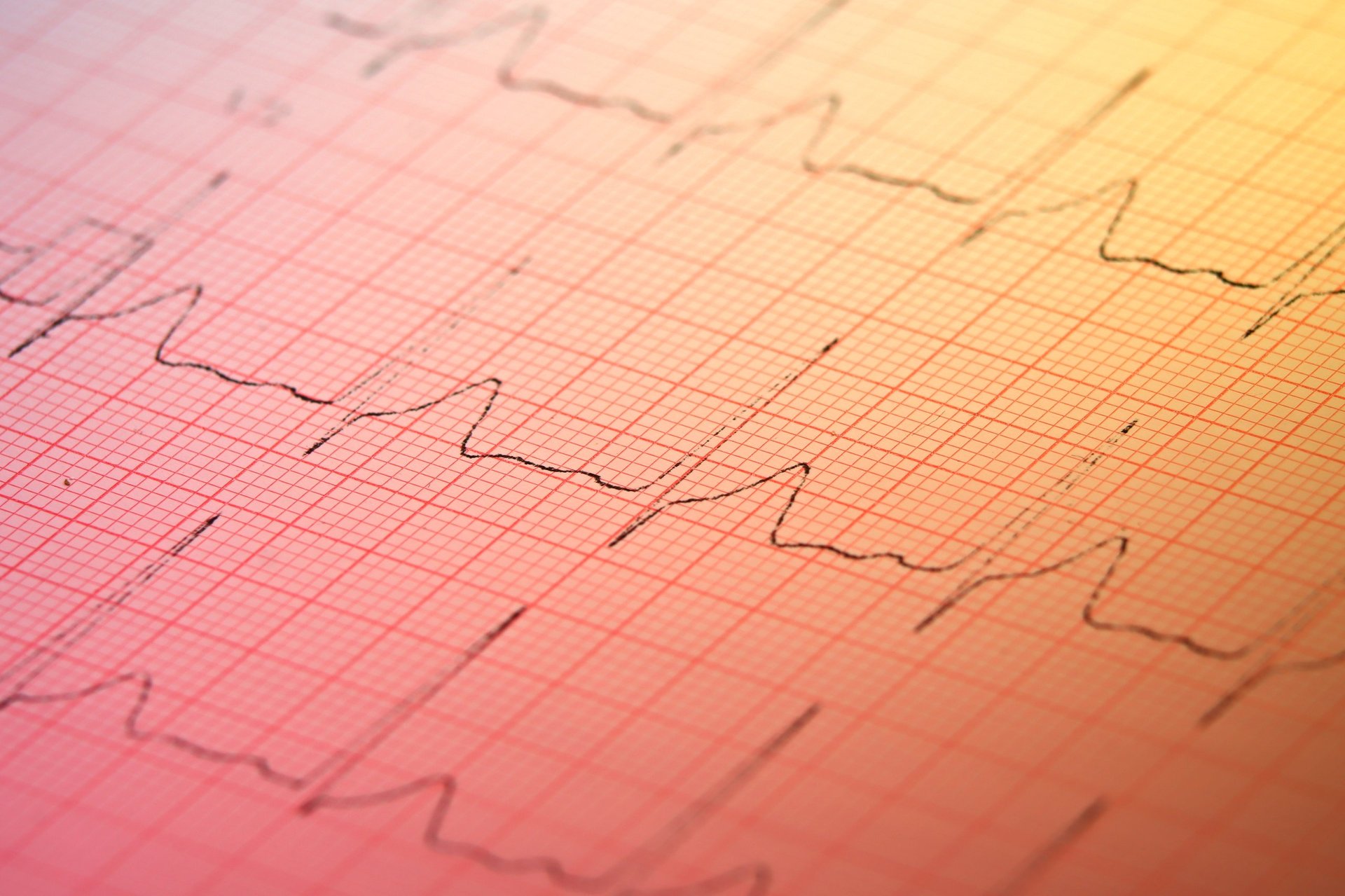 Heart rate measurement chart